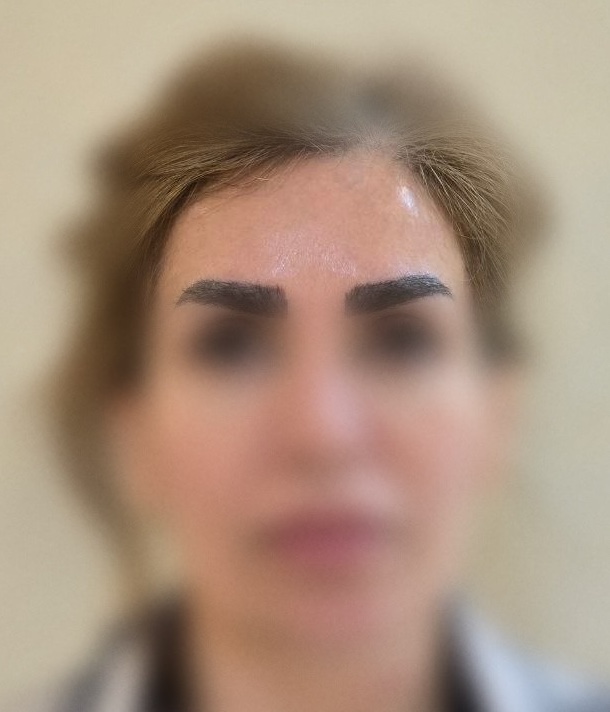 نمونه‌ی واقعی — مراجعه‌کننده‌ی لیانا